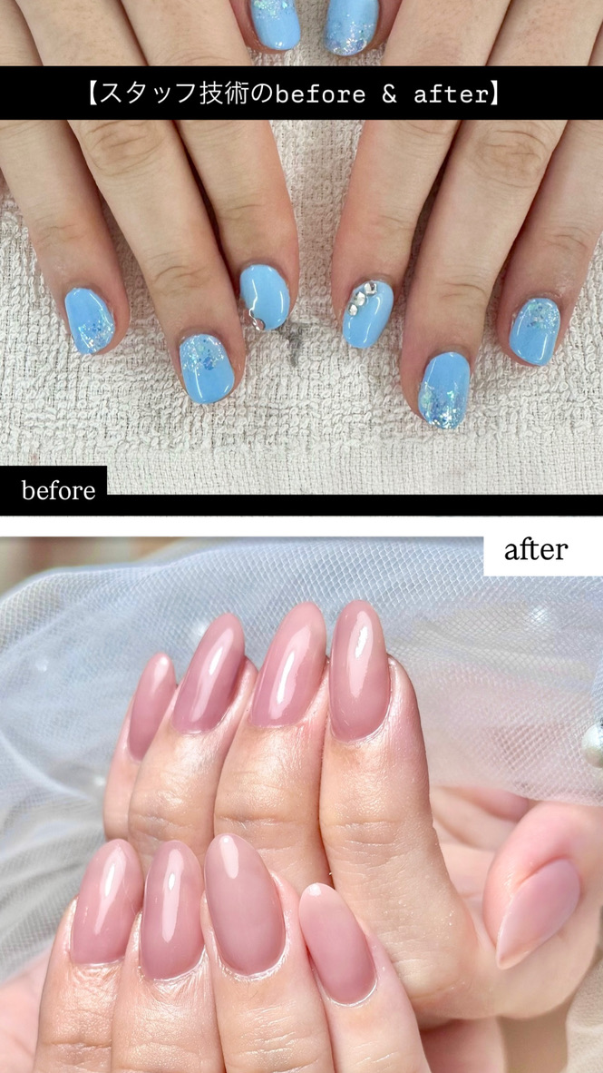 スタッフ技術 before & after